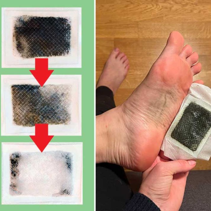 KIYOMI DETOX PATCH Drainage & Slimming Foot Patches
